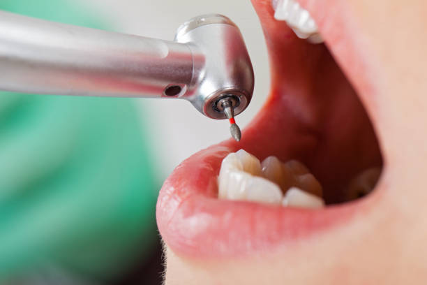 Best Broken or Cracked Tooth Emergency Dentist in Eupora, MS